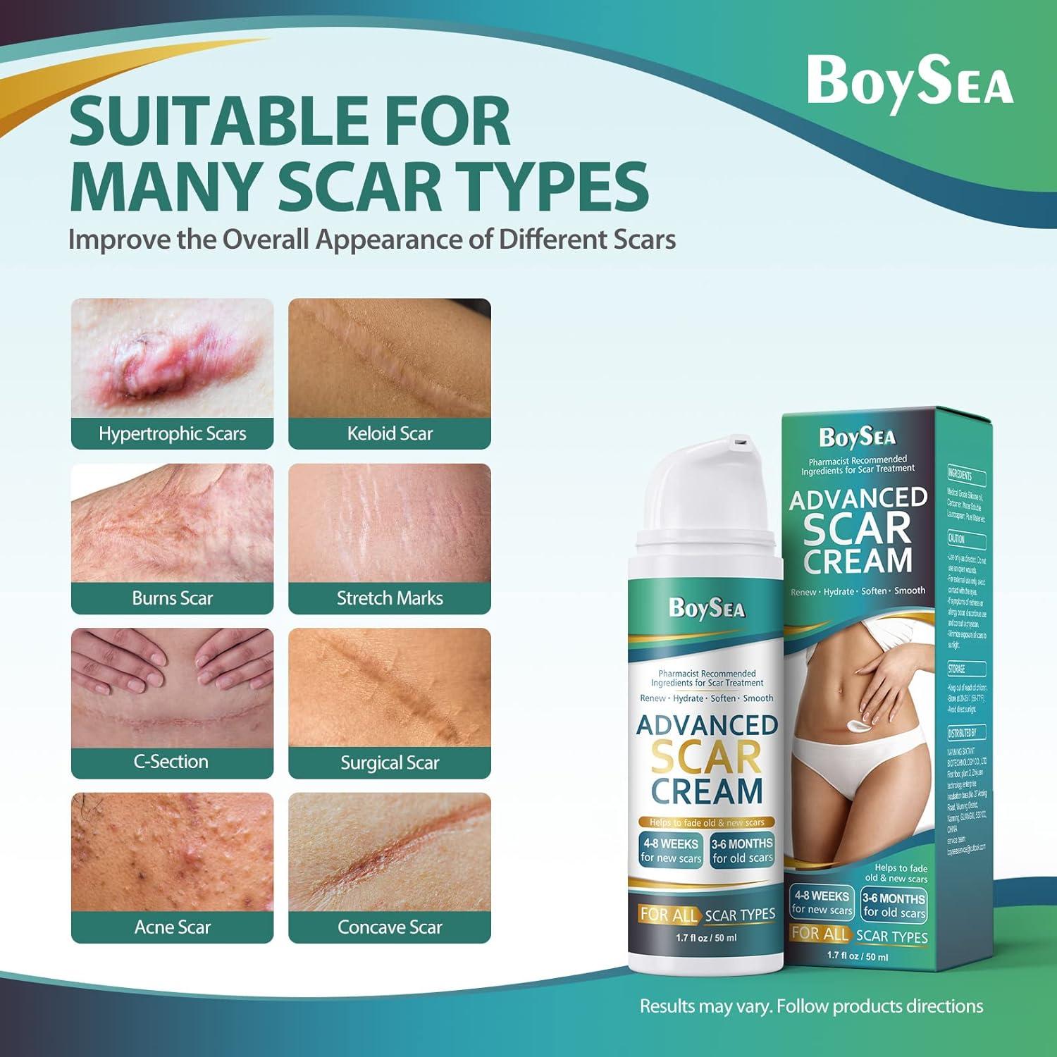 Crema para Cicatrices Boysea 50 ml - Tratamiento Avanzado