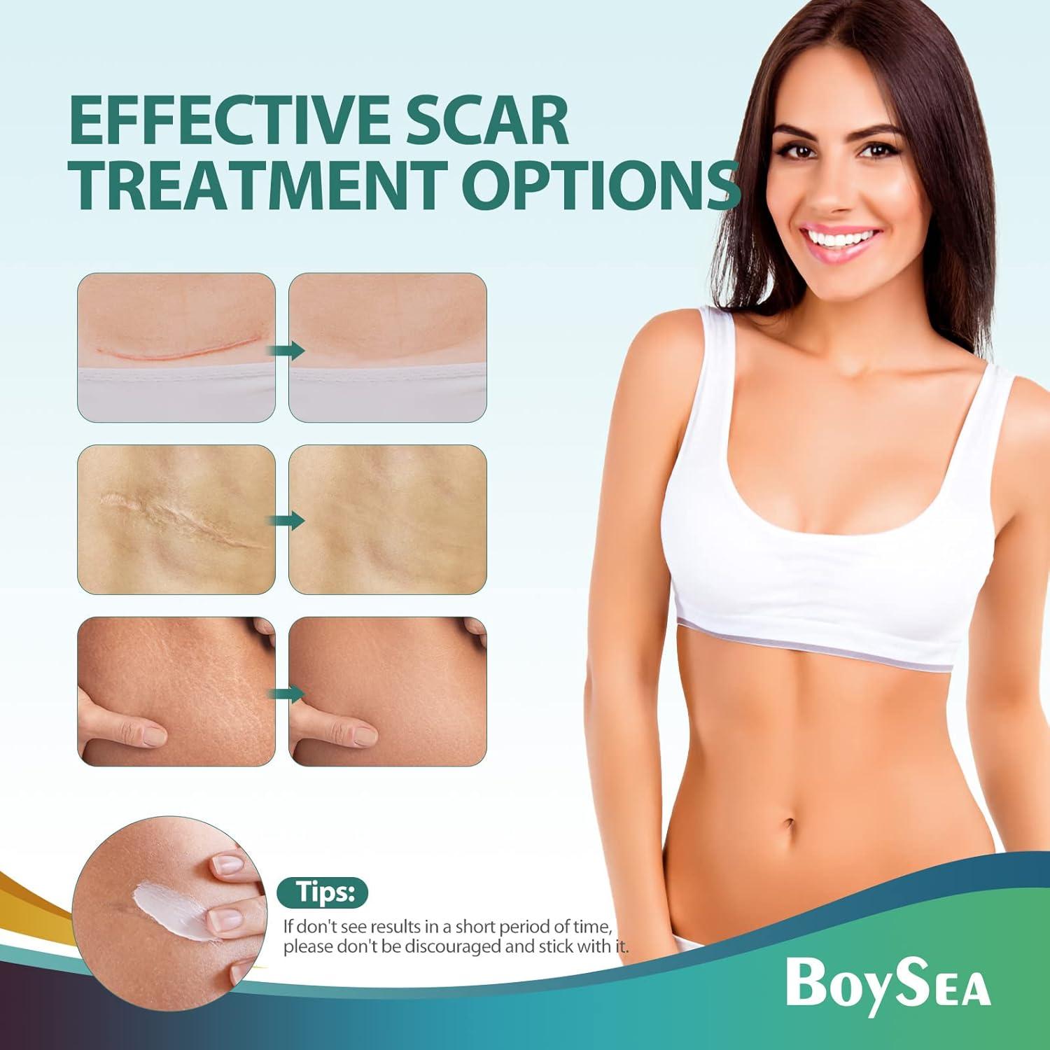 Crema para Cicatrices Boysea 50 ml - Tratamiento Avanzado