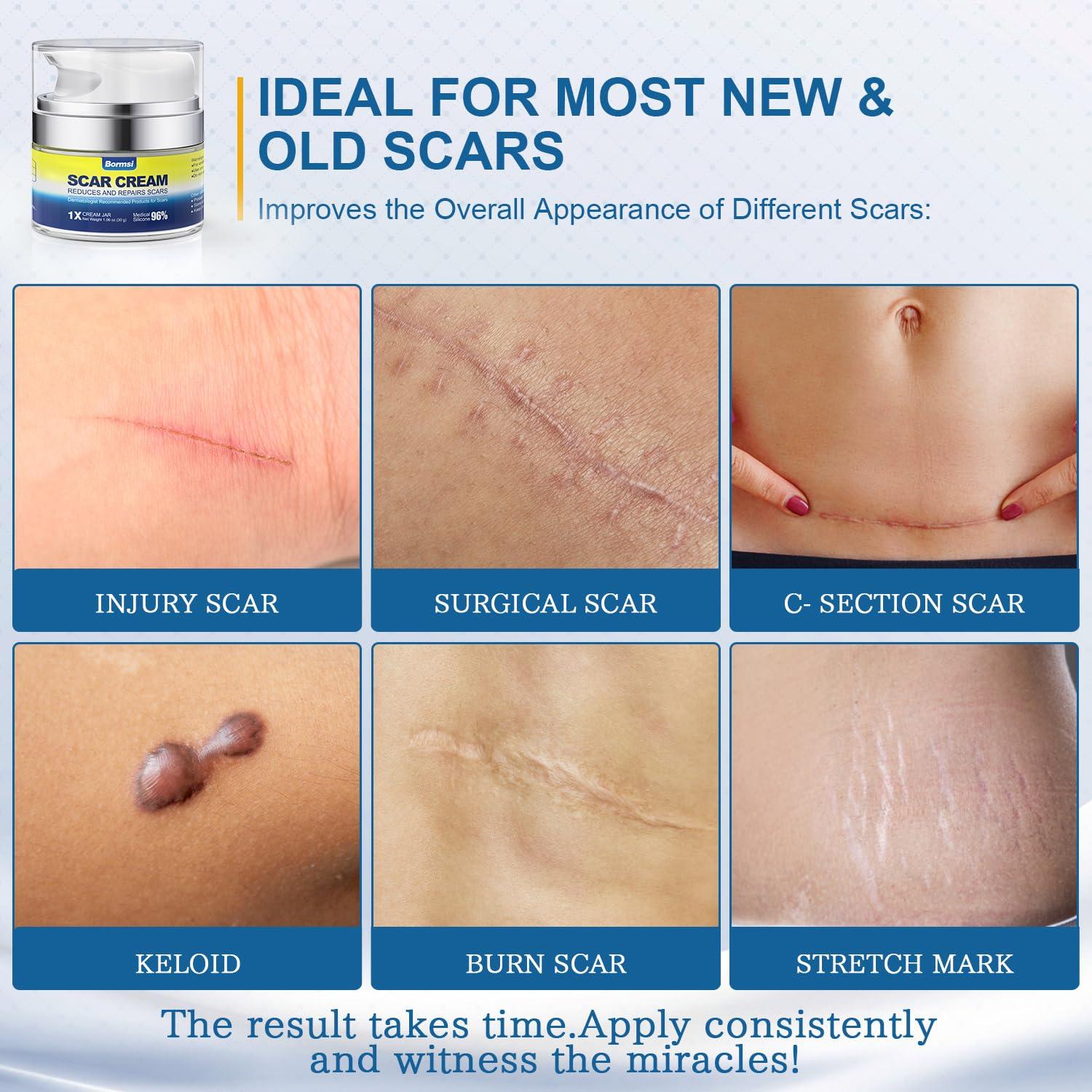 Gel de Silicona para Cicatrices Avanzado 30g - Shenzhen Liuxiang