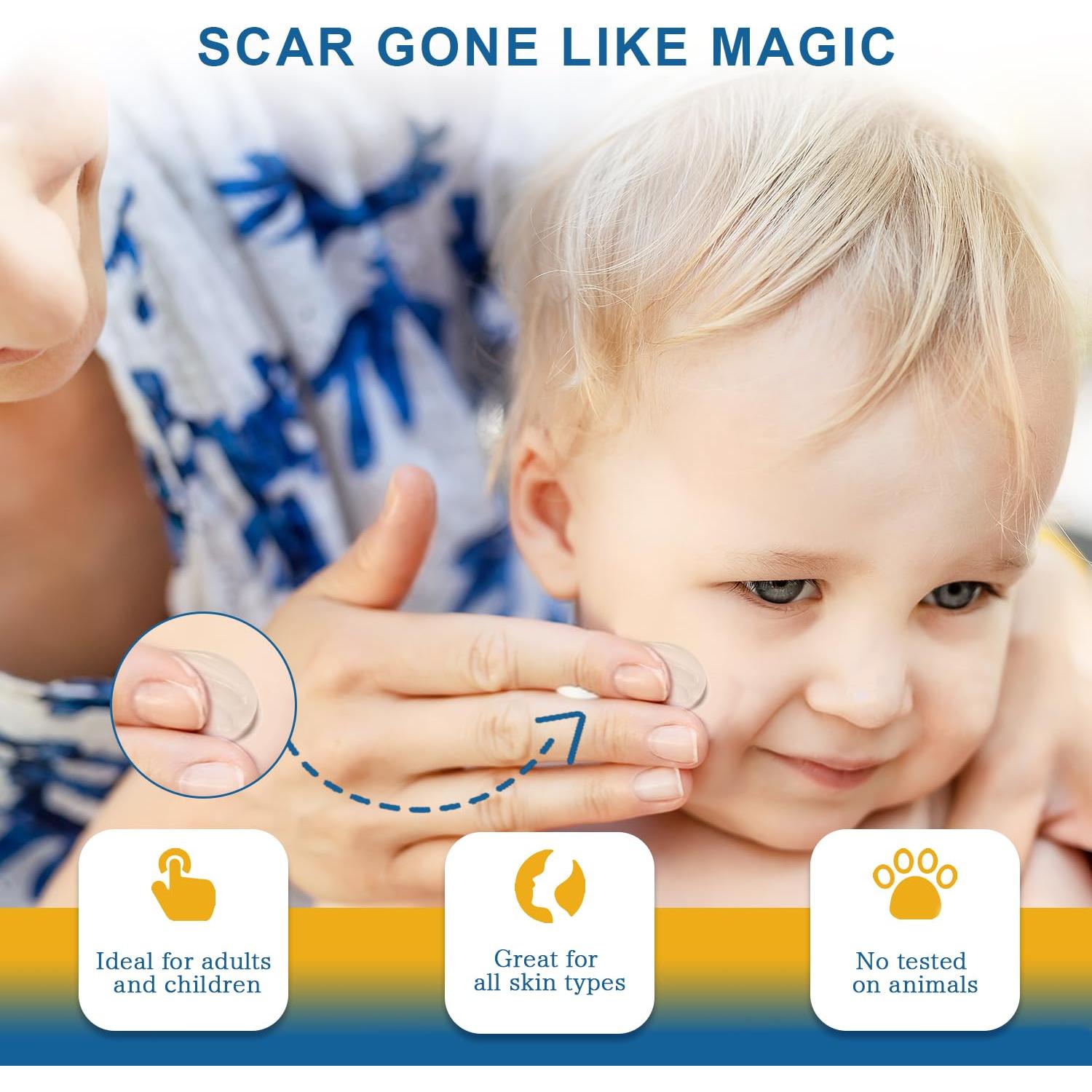 Gel de Silicona para Cicatrices Avanzado 30g - Shenzhen Liuxiang