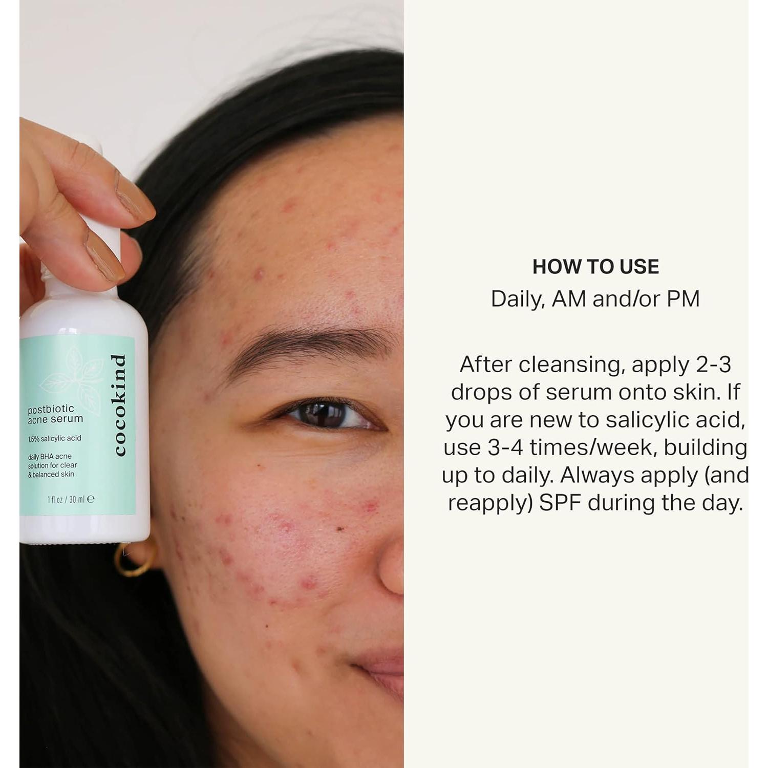 Suero Postbiótico Cocokind 1.5% Ácido Salicílico 28g