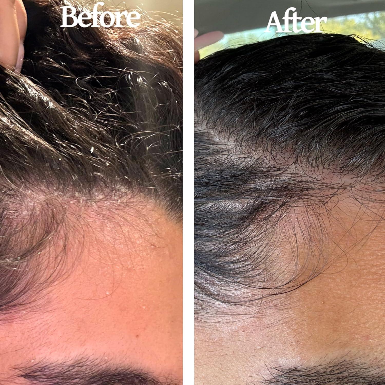 Set Aceite para Cuero Cabelludo y Cepillo Finalmente 368g