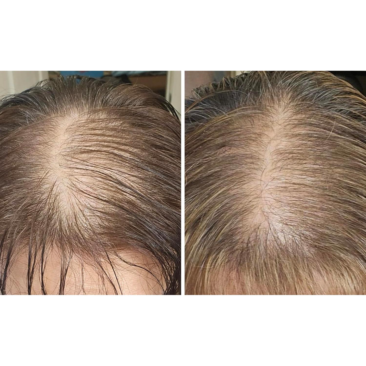 Set Aceite para Cuero Cabelludo y Cepillo Finalmente 368g