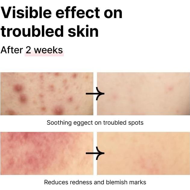 Esencia Tonificante ATEC 150ml | Aceite de Tamanu y Minerales