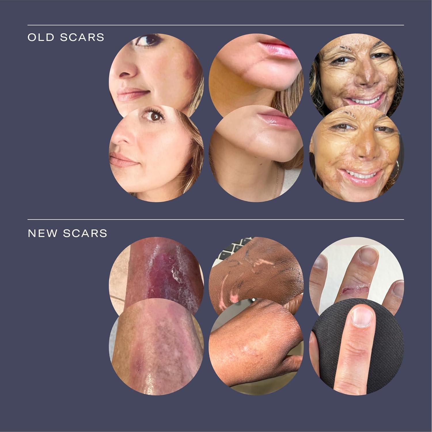 Crema para Cicatrices ESTAS Beauty 14.17 g - Vitamina E y C