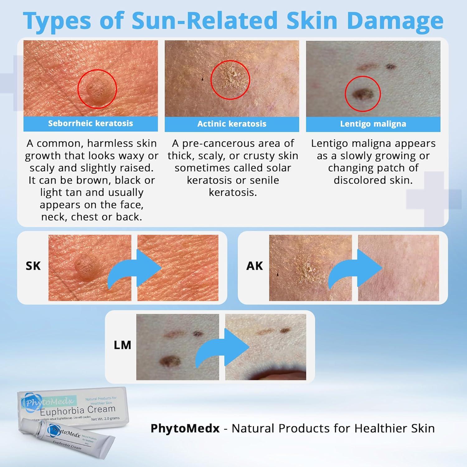 Crema de Euphorbia PhytoMedx 2g - Cuidado Piel Dañada Sol