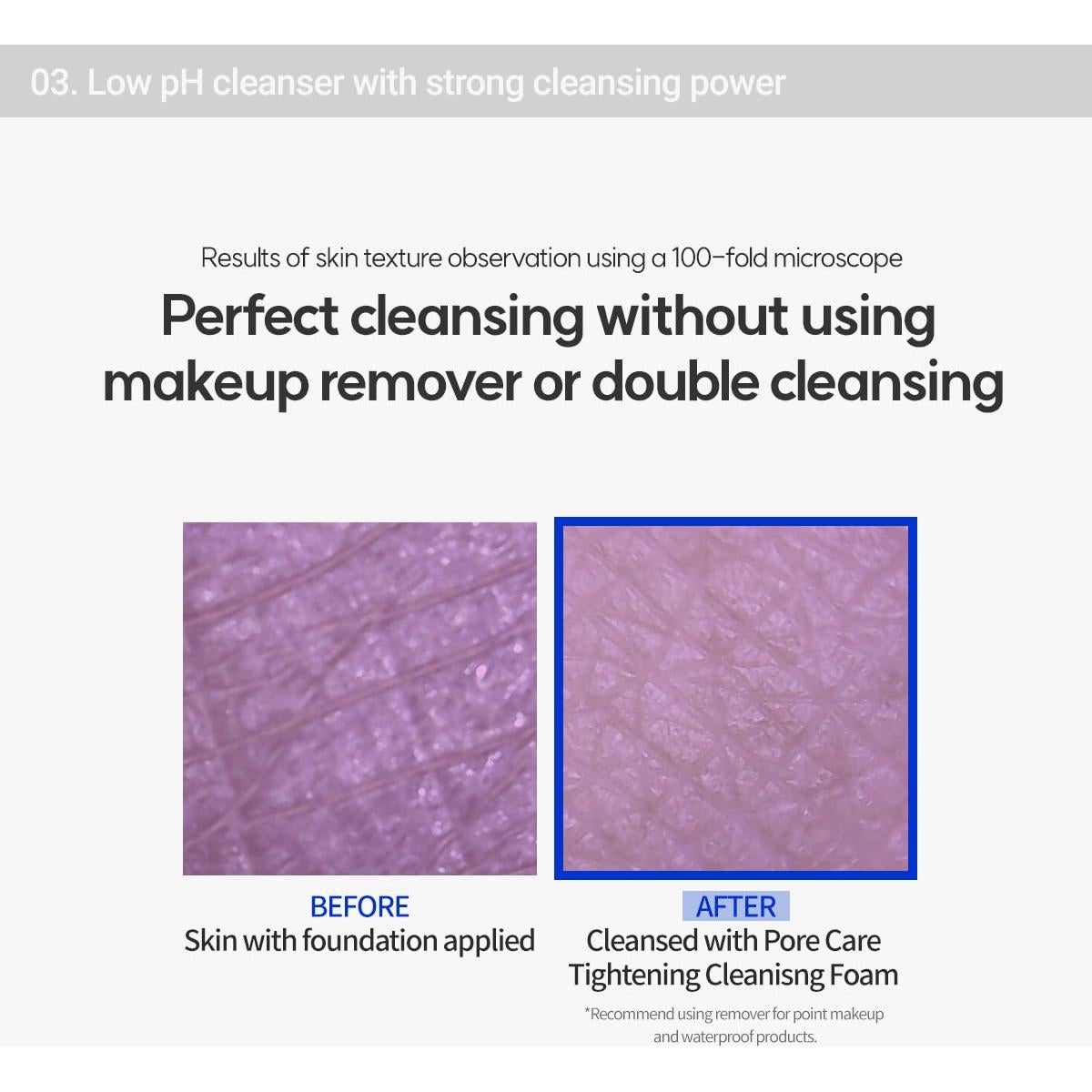 Espuma Limpiadora Rovectin 150 ml | AHA/BHA/PHA, Vegano