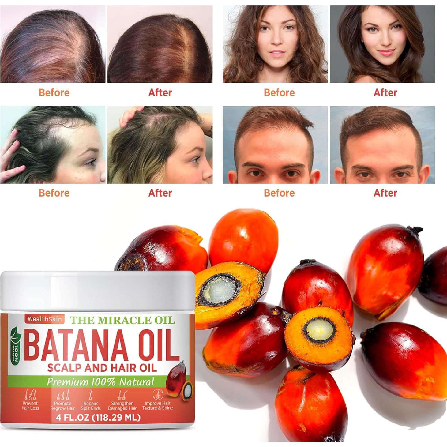 Aceite de Batana Wealthskin 118ml - Crecimiento y Reparación Cabello