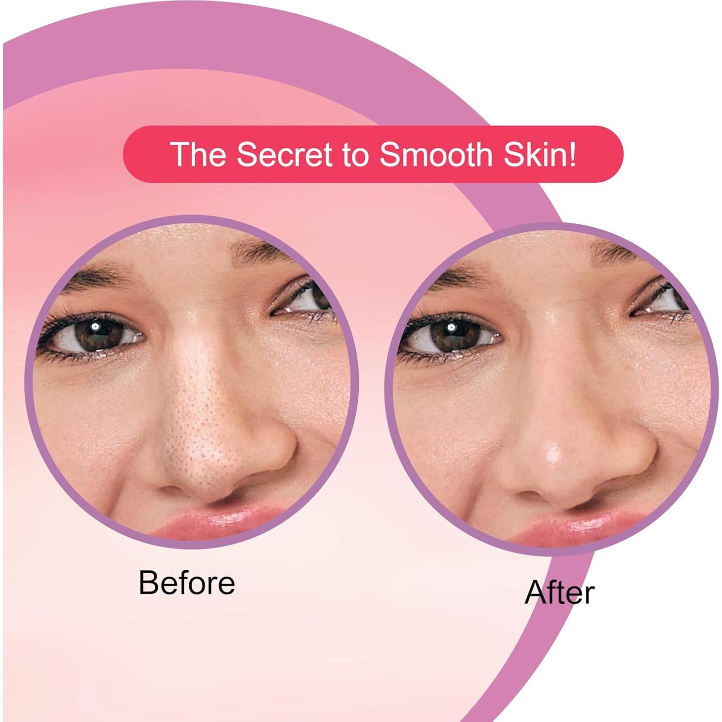 Tiras para la nariz DR.Rashel fresa 20 PCS limpieza profunda