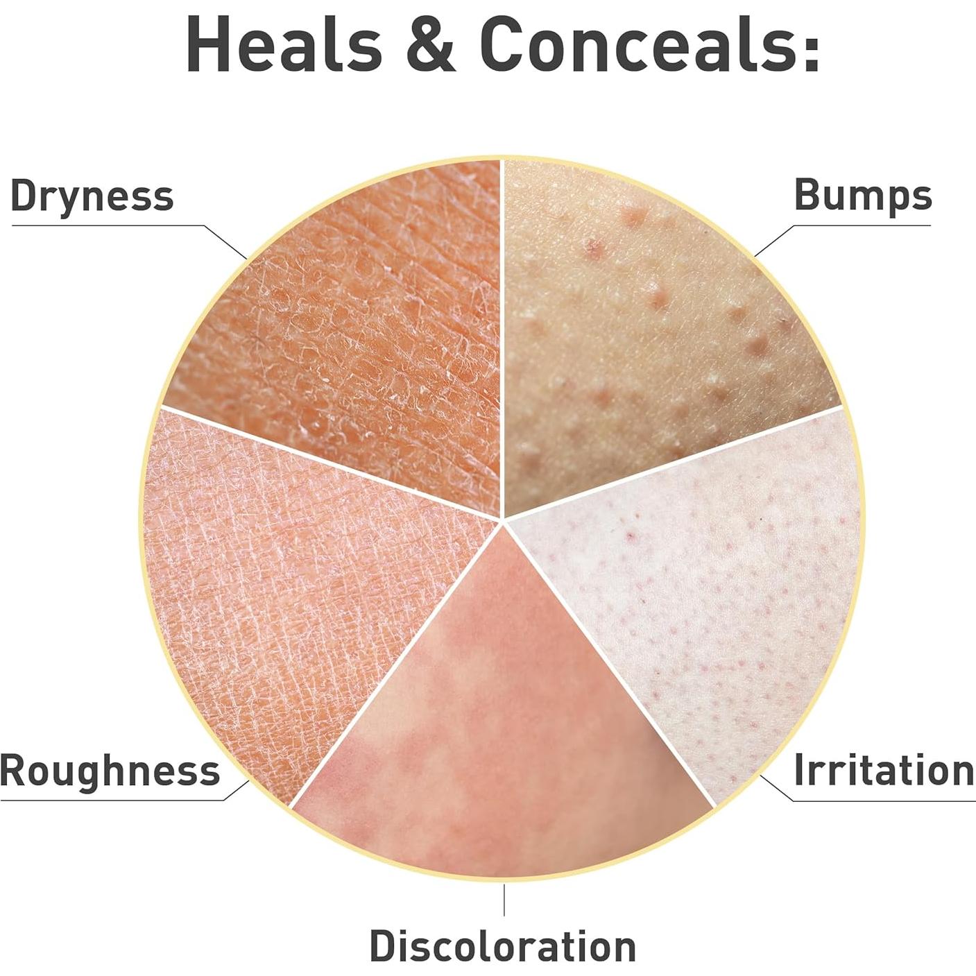 Crema Exfoliante para Queratosis Pilaris Procure 170 g