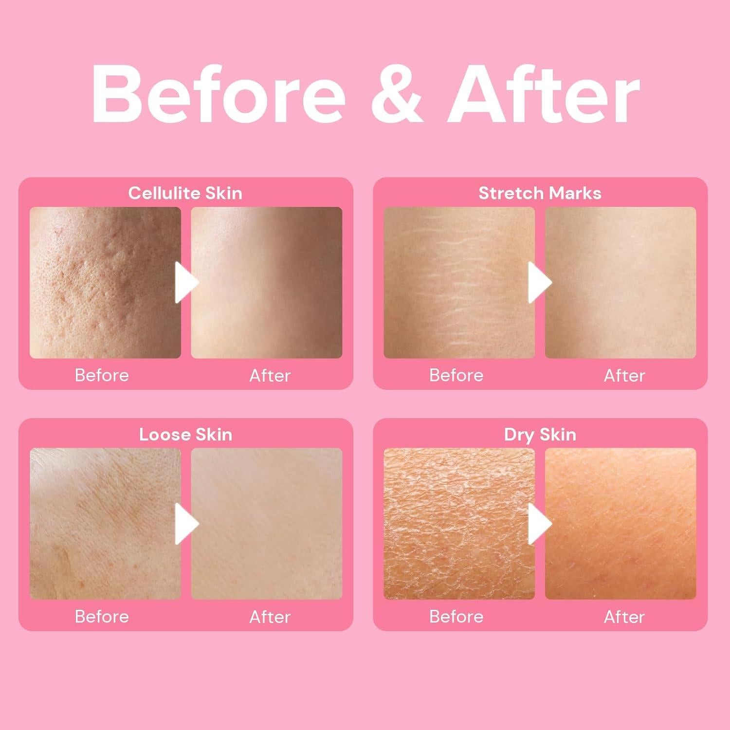 Crema Anticelulitis Enaskin Naturals 90 ML - Reafirmante y Hidratante