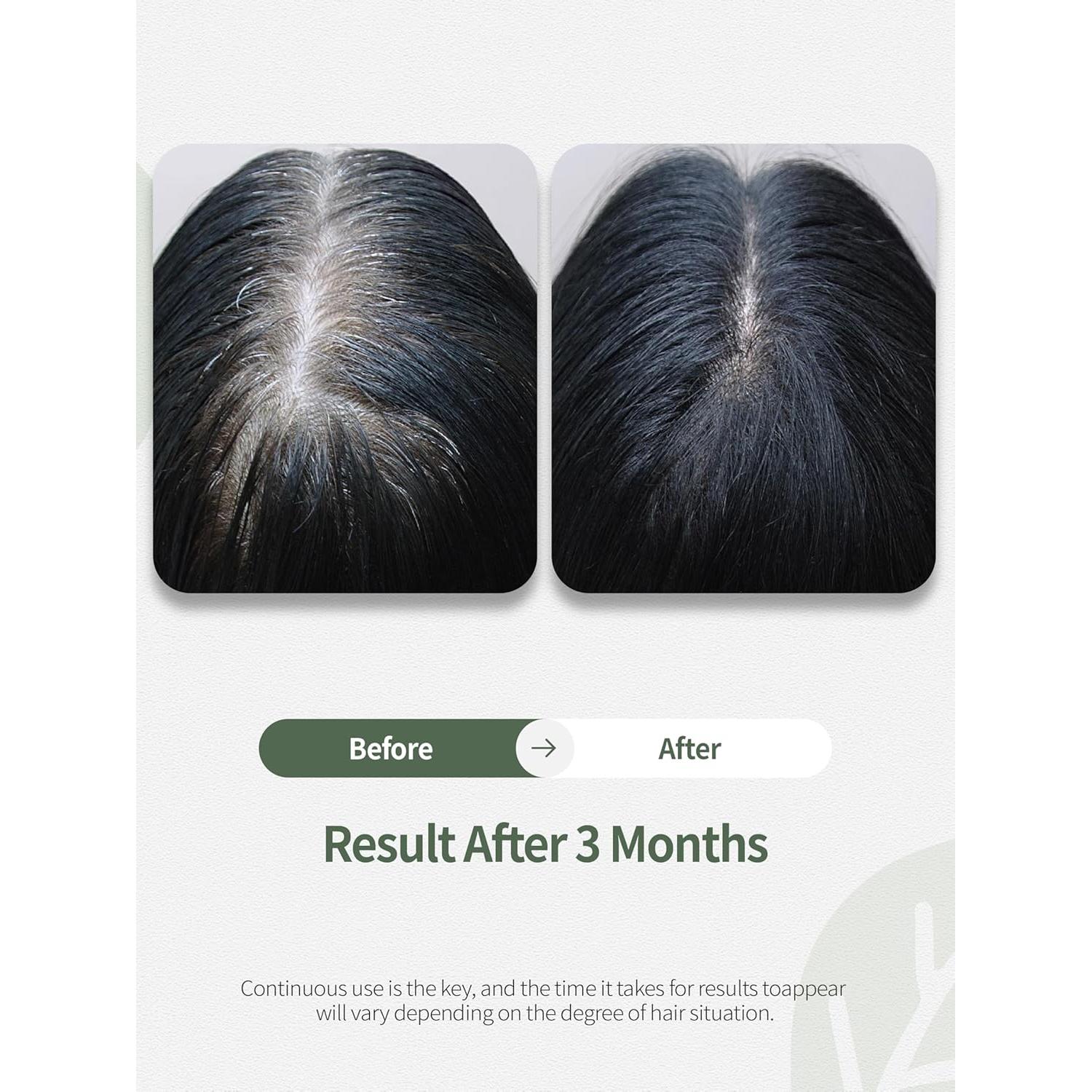 Suero Capilar DORPANG 59 ml - Nutre y Fortalece el Cuero Cabelludo