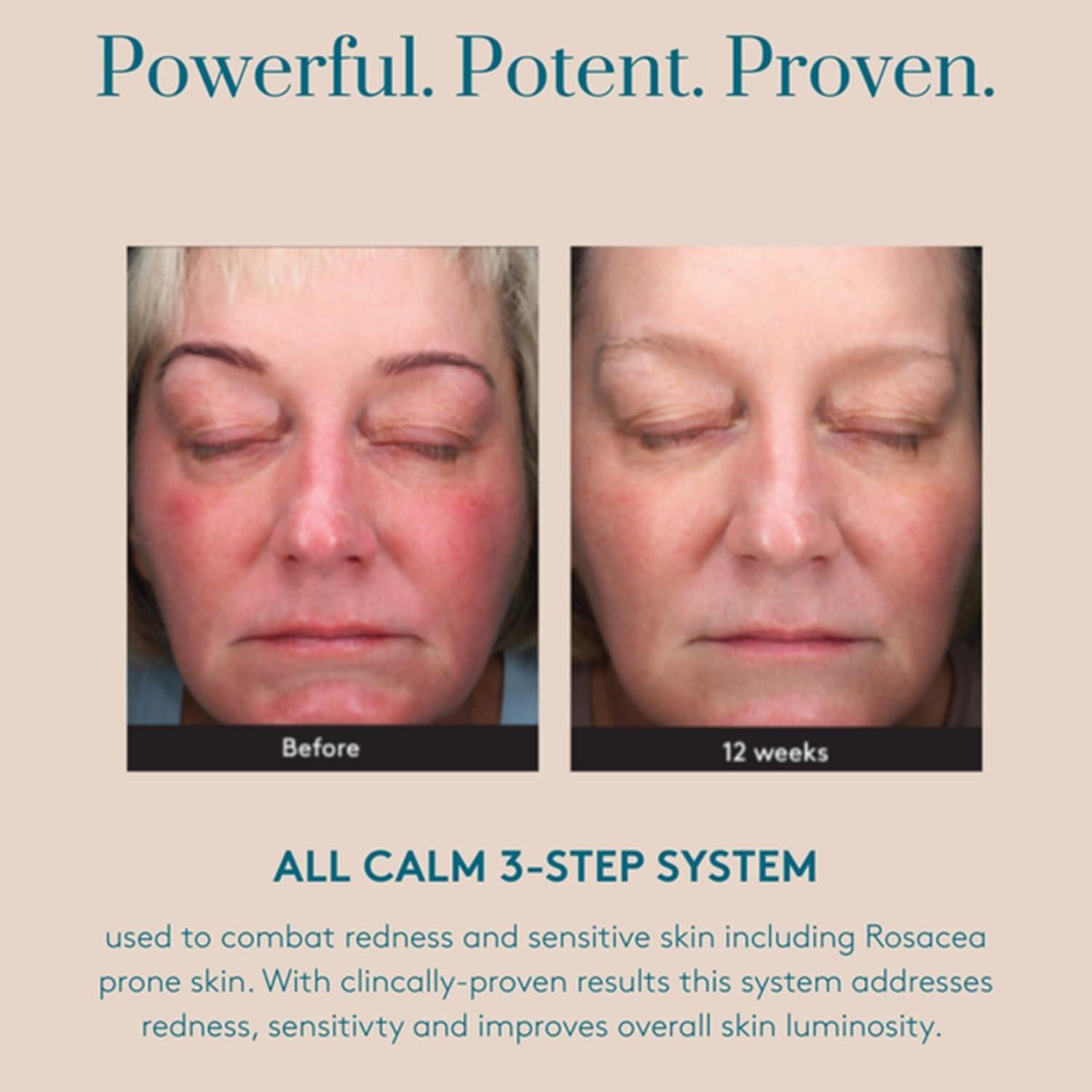 Suero Multi-Corrección All Calm Colorescience 29.57 ml