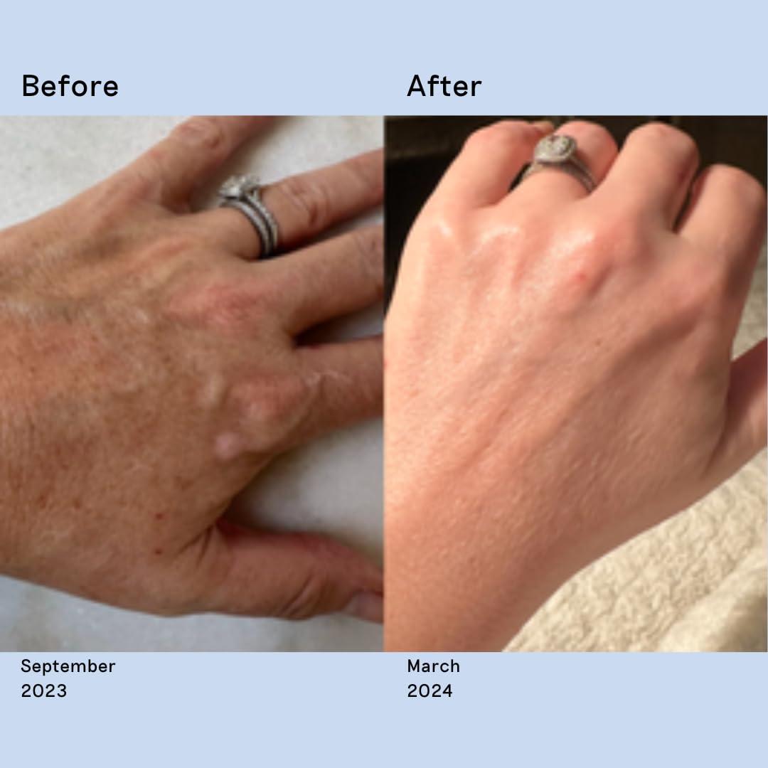 Set Cuidado Piel Anti-Envejecimiento Habelo - Suero + Guantes