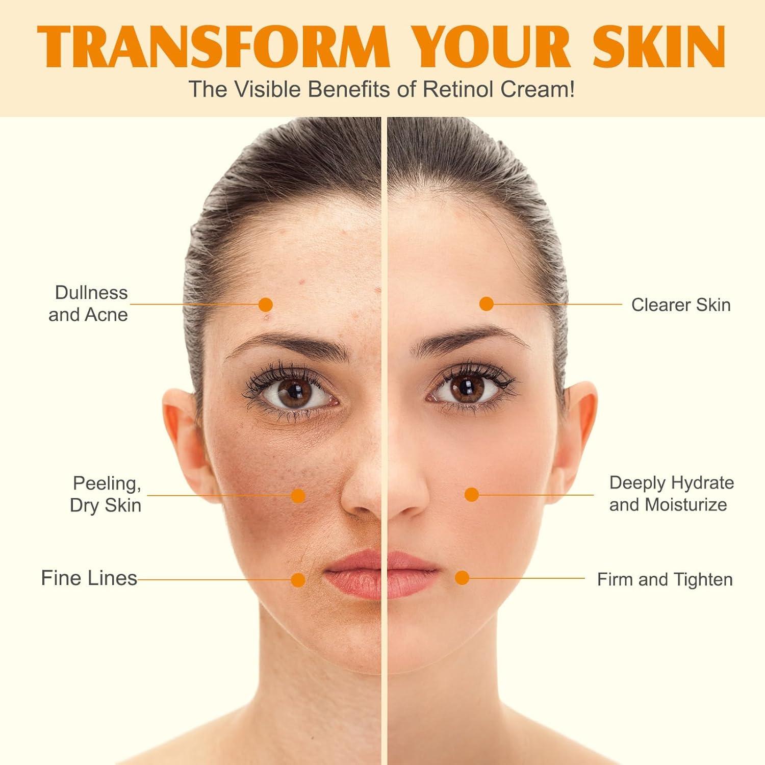 Crema Balsamo de Sebo Batido JHZZDZSWYXGS 60g - Hidratante Piel Seca