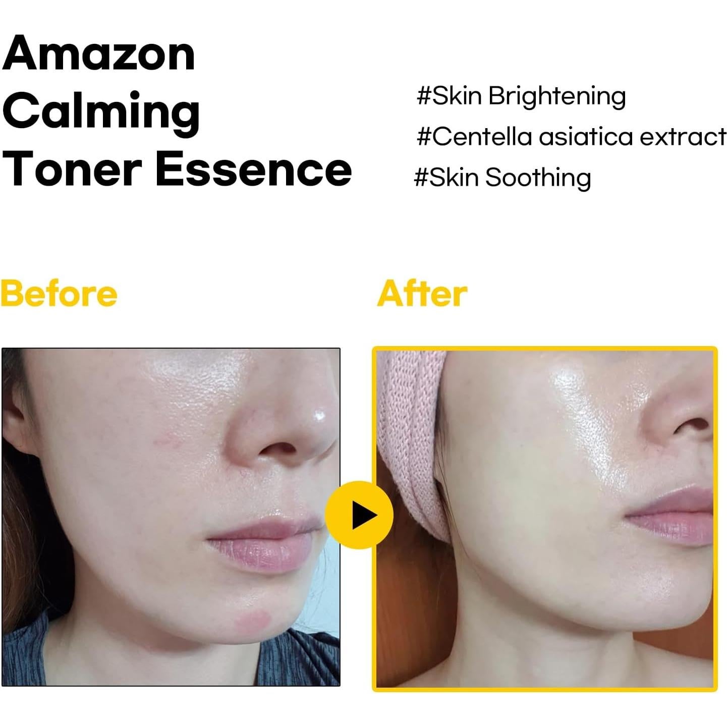 Tónico Calmante de Propóleos Rojos Bbh 120 ml Hidratante