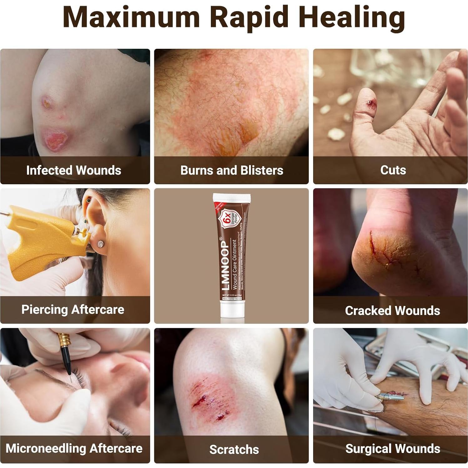 Crema para Heridas LMNOOP 15g - Sanación y Reparación Piel