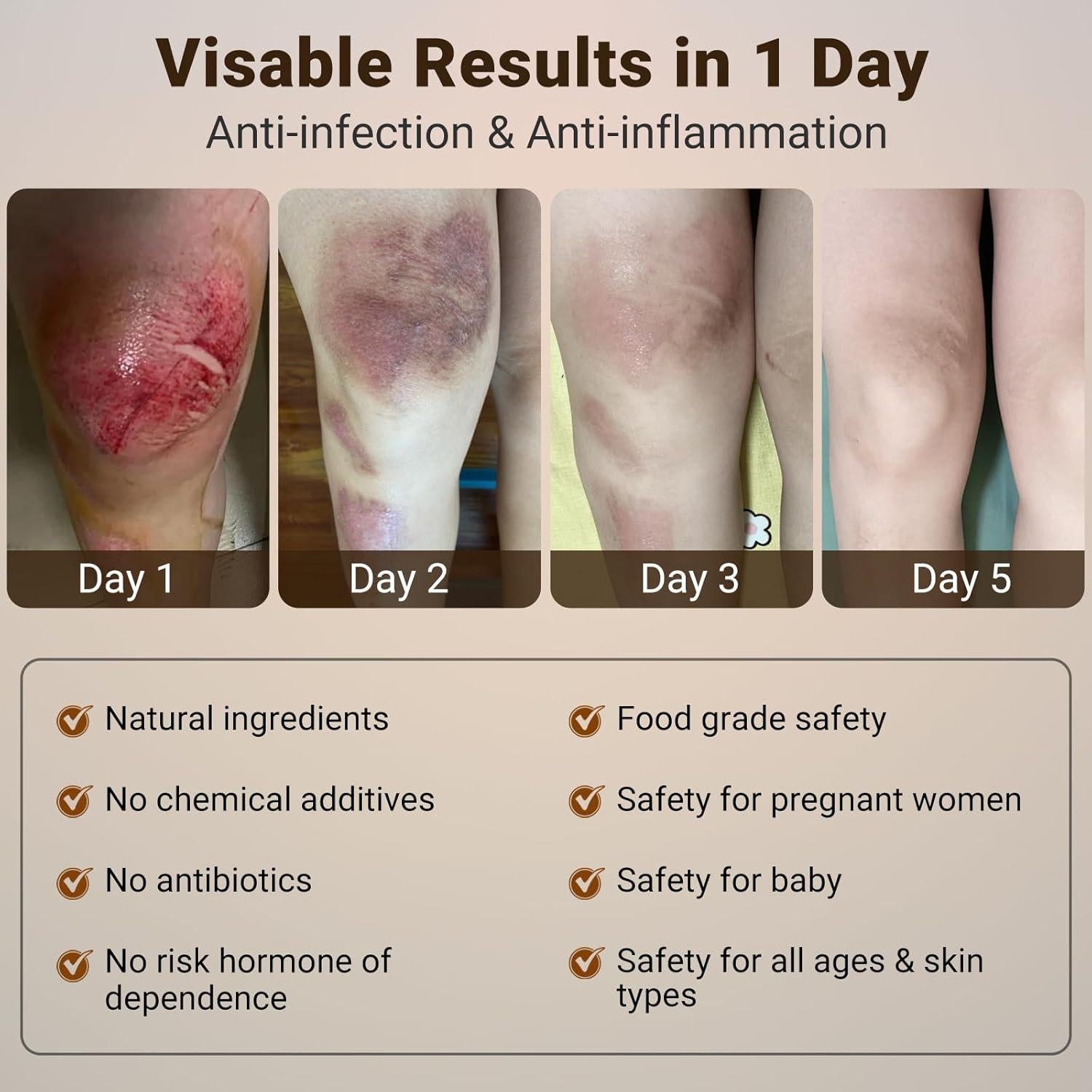 Crema para Heridas LMNOOP 15g - Sanación y Reparación Piel