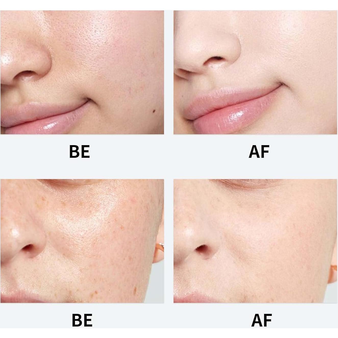 Crema Hidratante Coreana Genérica 100ml - Fórmula Youthful