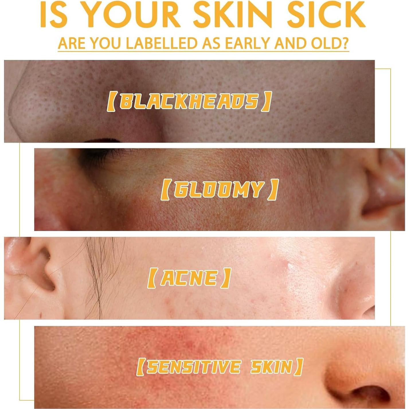 Máscara de Tearing de Miel Glowtulip 2PC - Limpieza Profunda y Control de Puntos Negros