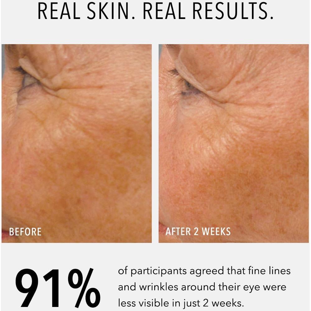 Suero Facial HydroPeptide LumaPro-C 28g - Corrector de Piel