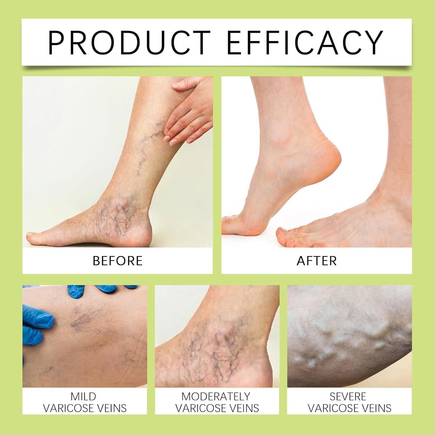 Bálsamo Milagroso 2-Pack SUGOYO 30g - Crema Herbal Relajante