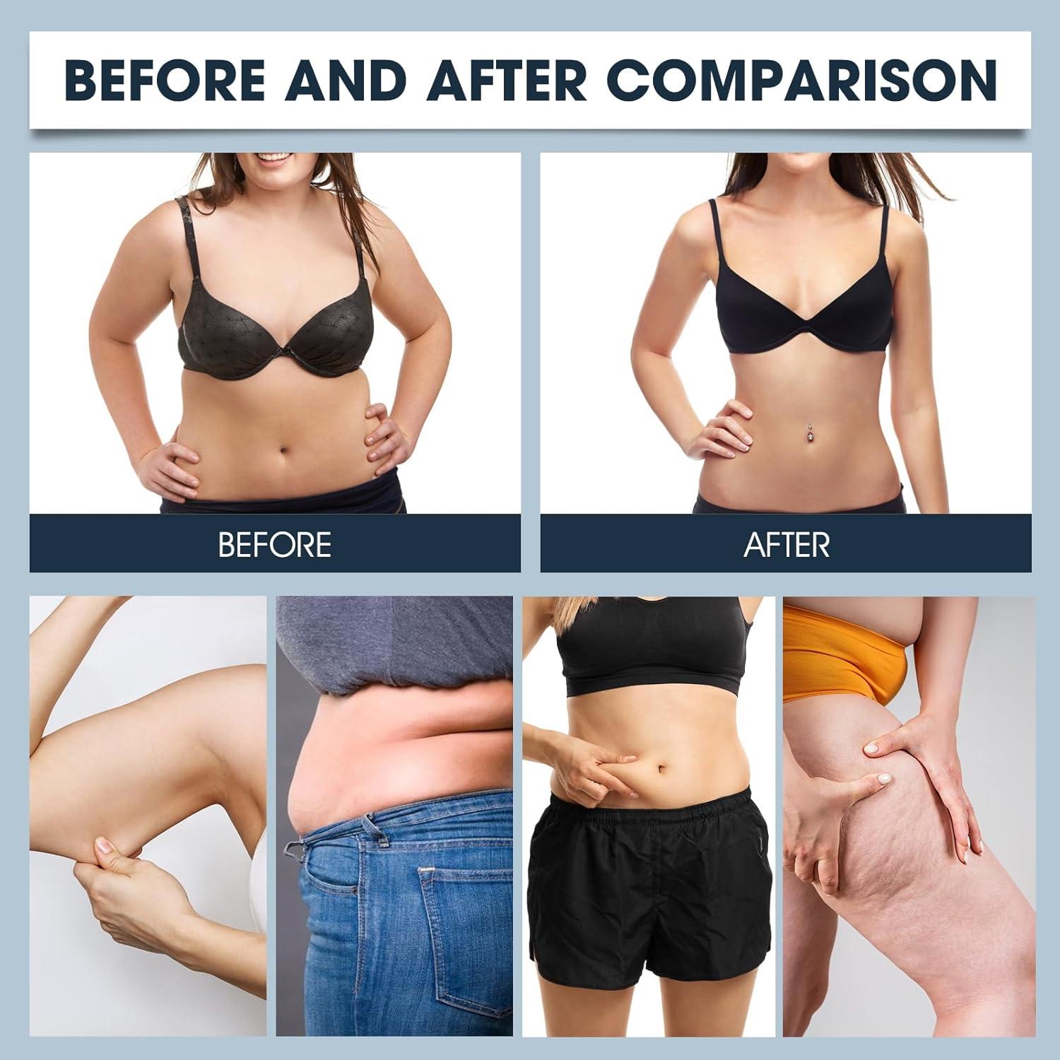 Parches Ozem 36PCS Naturales Hidratantes para Mujeres