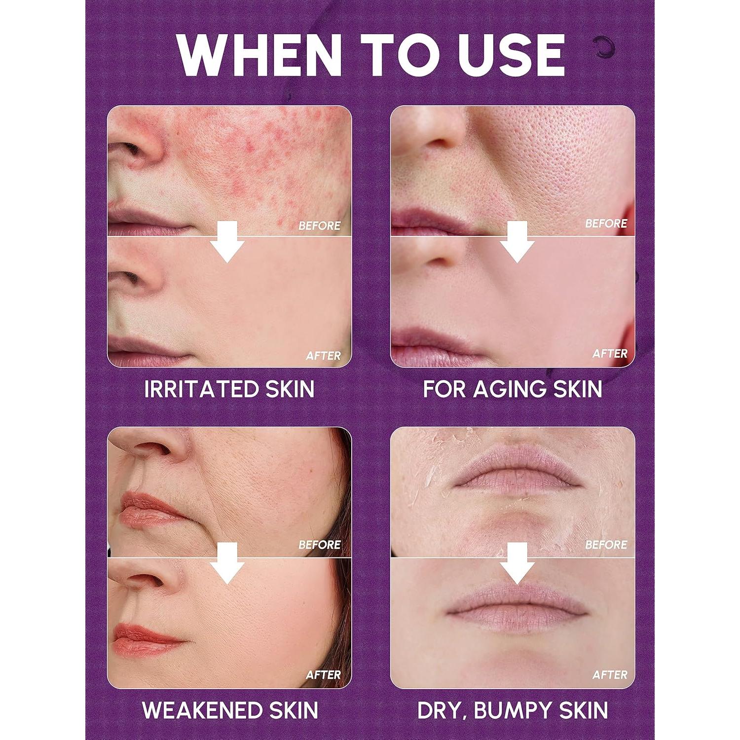 Tónico Facial Hidratante Coreano DERMAMEAL 200 ml Piel Seca