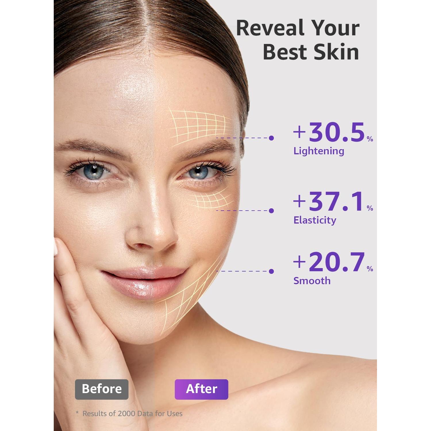 Gel Conductivo VITALY 2PCS 82.96 ml - Hidratante Facial