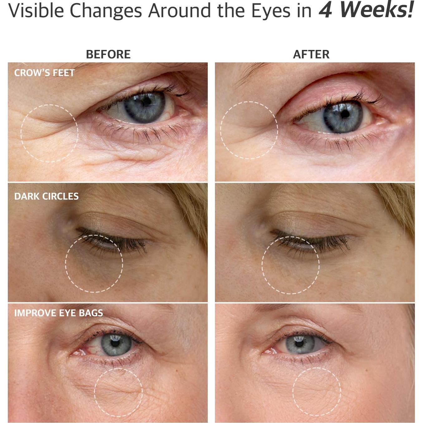 Crema para los Ojos Antienvejecimiento RTS 30 ml con Caracol