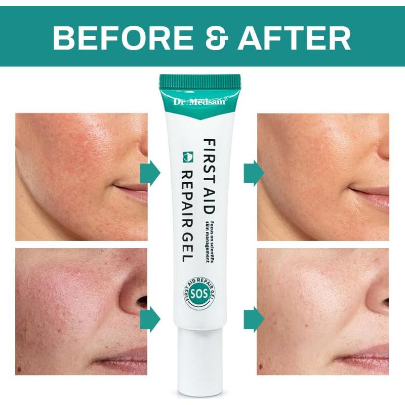 Gel Reparador Hidrogel Dr.Medsam 20g para Quemaduras Solares