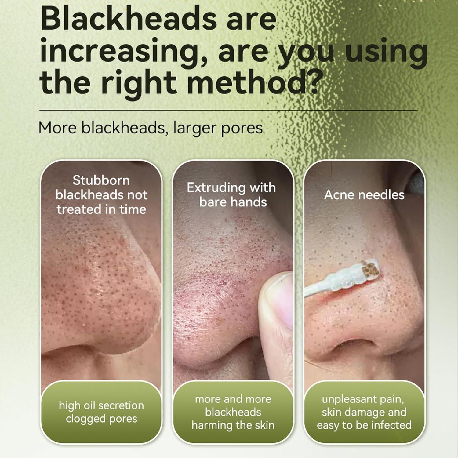 Mascarilla Quitacomedones Vemofoper 60 pcs - Limpiador de Poros