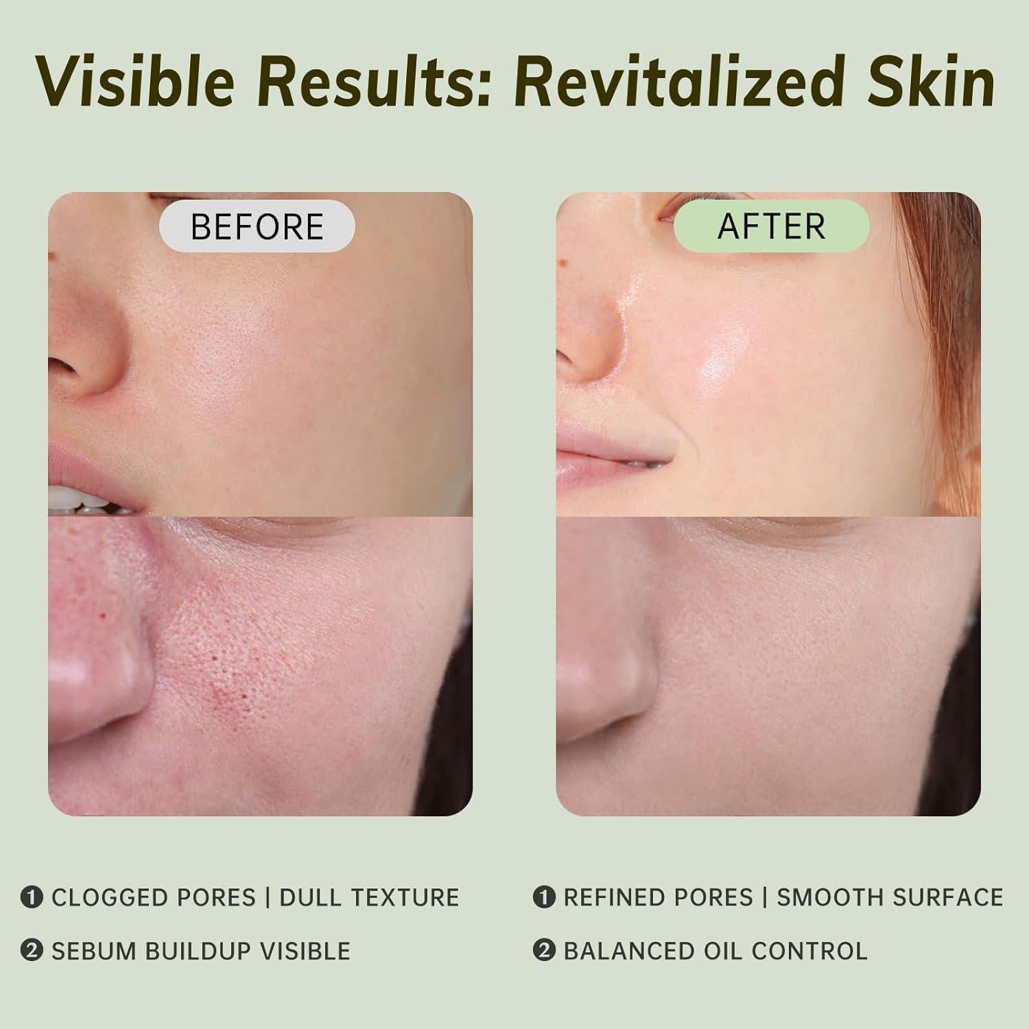 Gel Exfoliante Suave GONIM 15 Unidades 2.83 g Piel Sensible