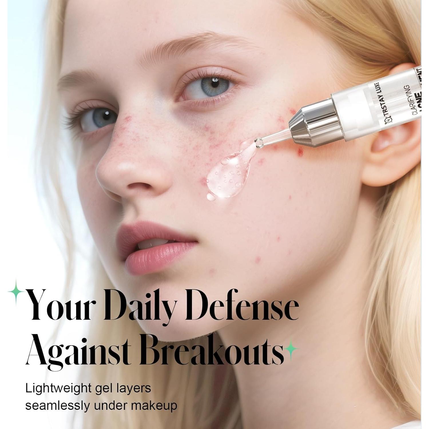 Gel Tratamiento Acné Ácido Salicílico 2% TRSTAY LUXE 10.4 ml