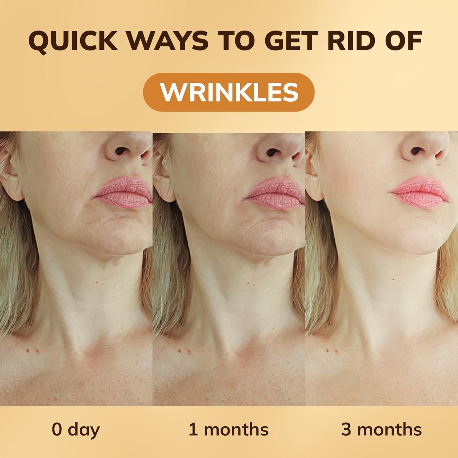 Ampollas Antiarrugas Abera Gold - Suero Antienvejecimiento 3x6.8ml