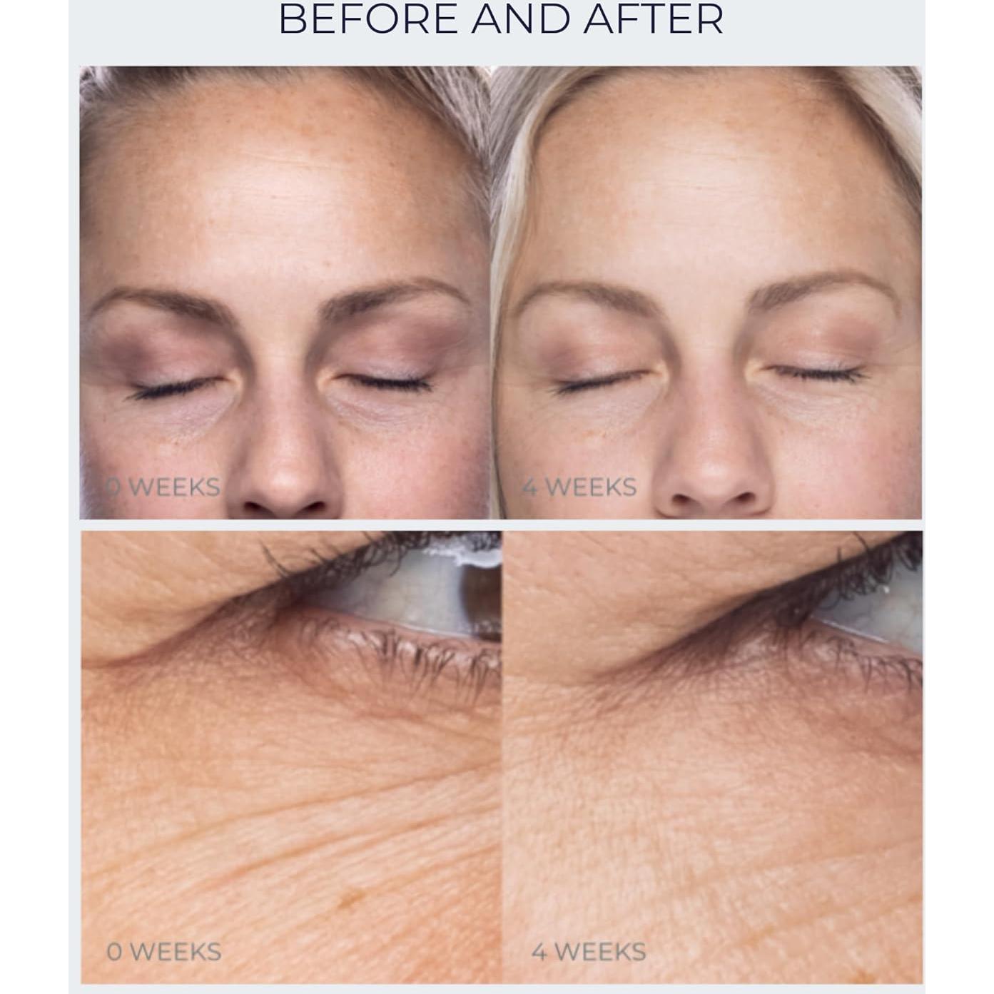 Crema para los Ojos Anti-Envejecimiento Alana Mitchell 15 ml