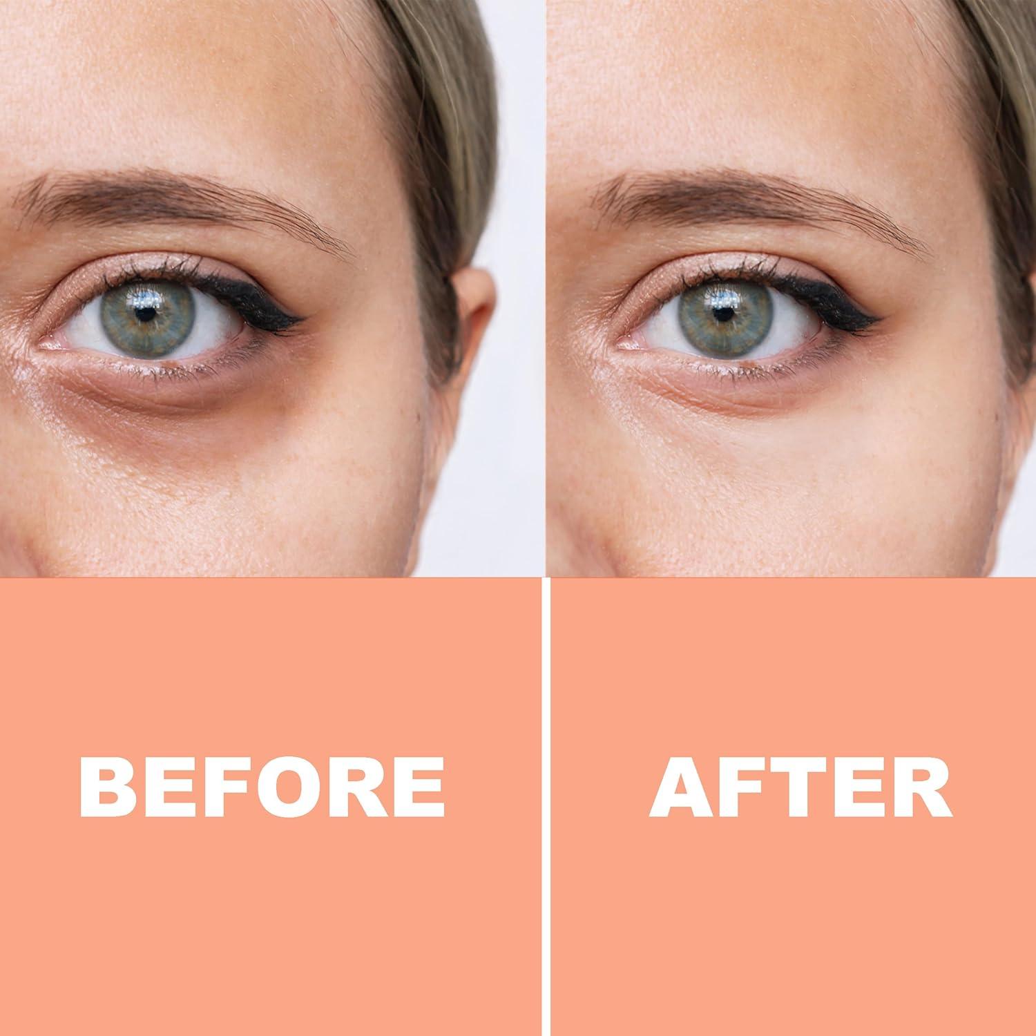 Crema Iluminadora para Ojos Pure Fiji Vitamina C 15ml