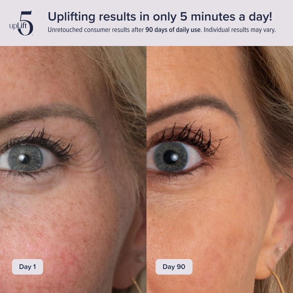 Dispositivo de Reversión de Edad upLift 5 - Tonificación Facial