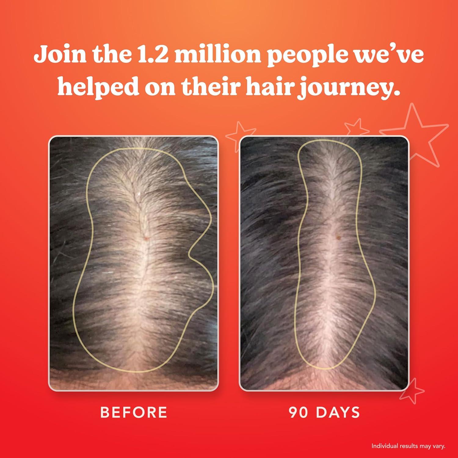 HAIRtamin Suplemento Vitamínico para el Cabello 30 Cápsulas