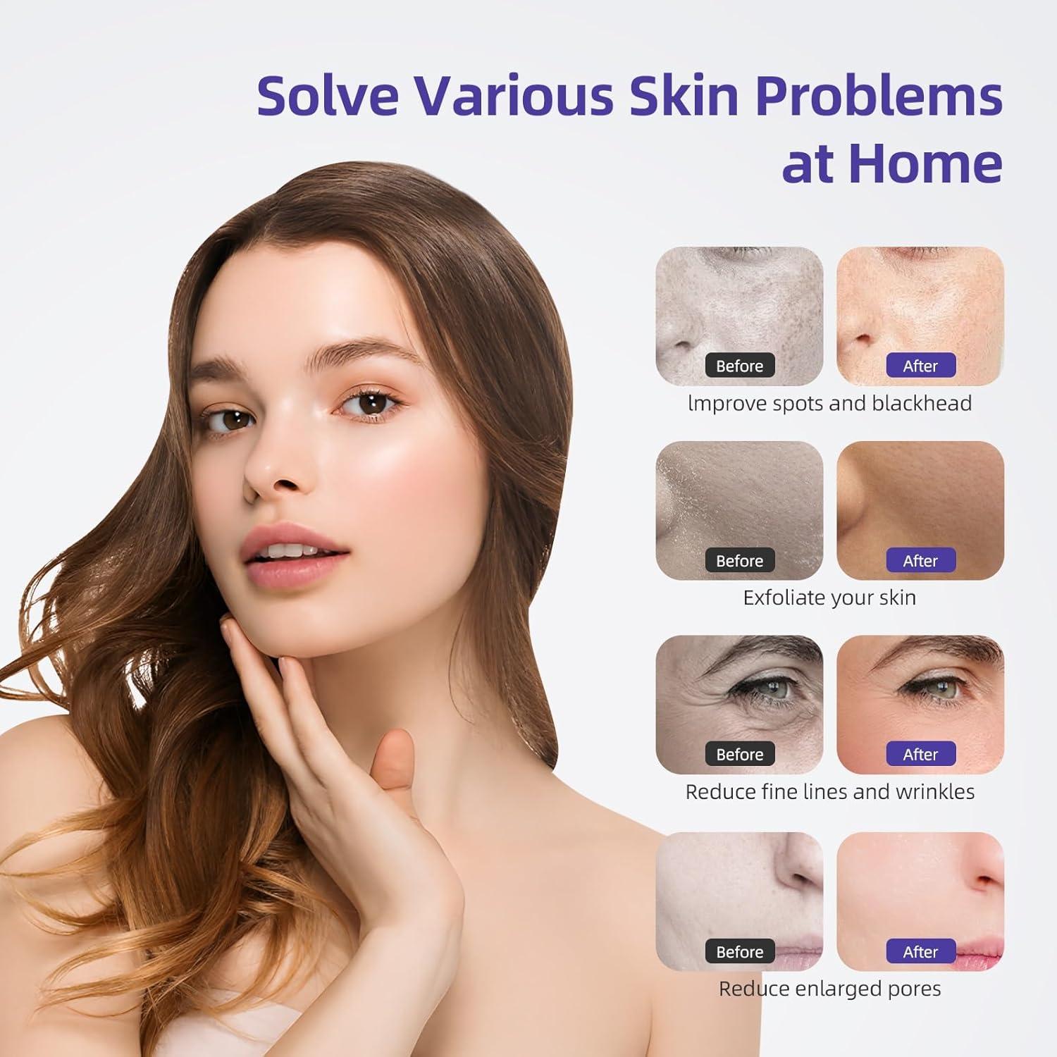 Máquina de Microdermoabrasión Diamante IeBilif 3 en 1 con Vacío