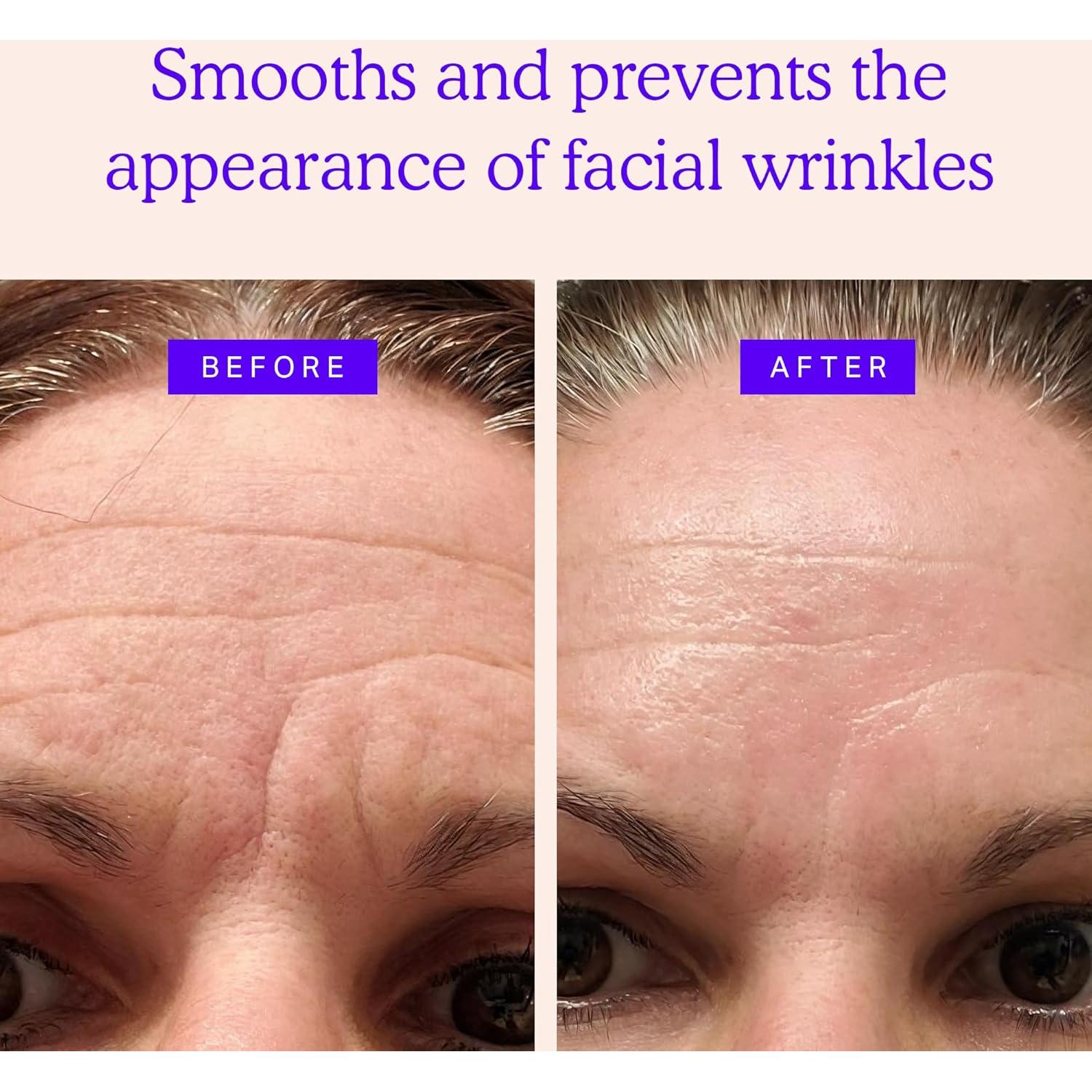 Parches Faciales Antienvejecimiento Blumbody - 160 Parches