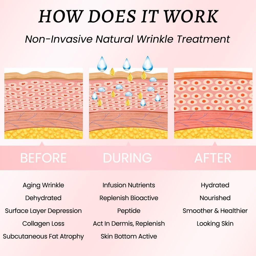 Cintas Médicas Faciales para Arrugas evpct 192 Pcs - Silicona