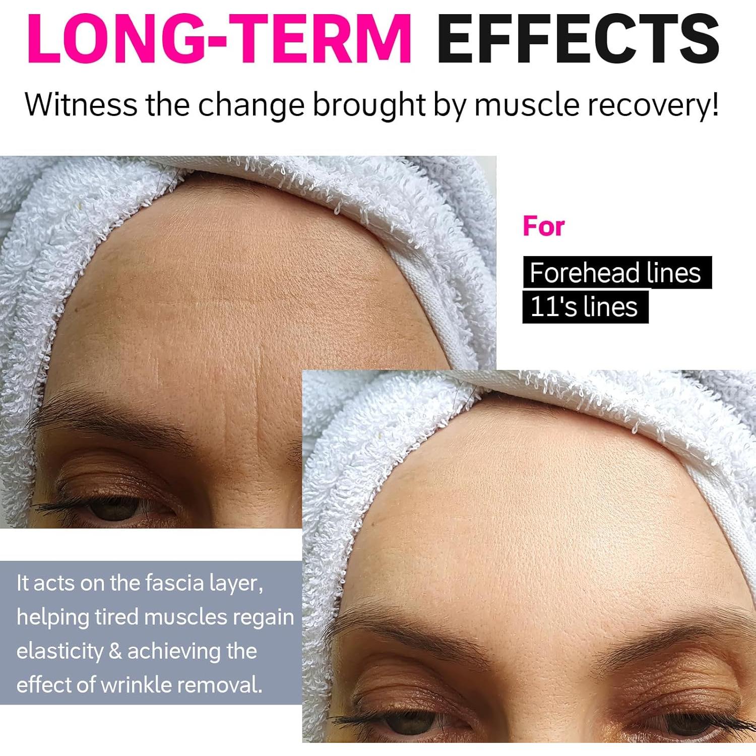 Parches Faciales Antiarrugas Akissos 15 PCS para Frente