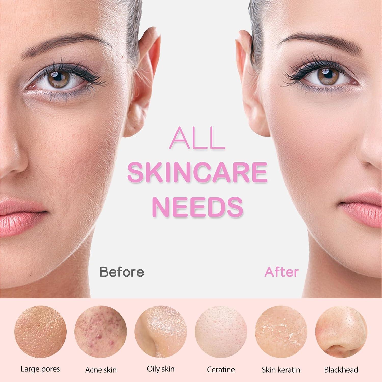 Cepillo Facial PRITECH Recargable con Calentamiento 40°C Rosa