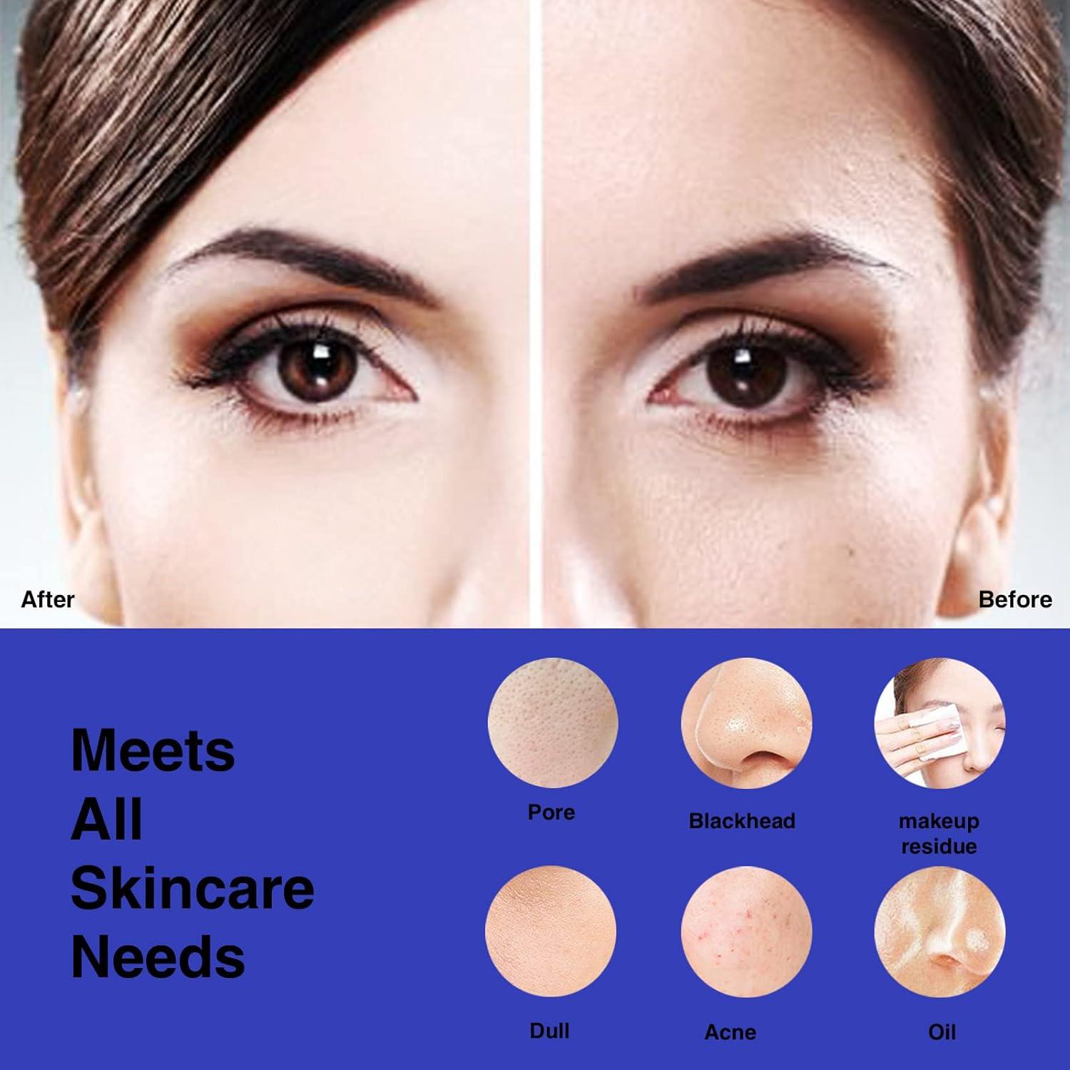 Cepillo Facial Limpiador NågraCoola CLIE Recargable Azul