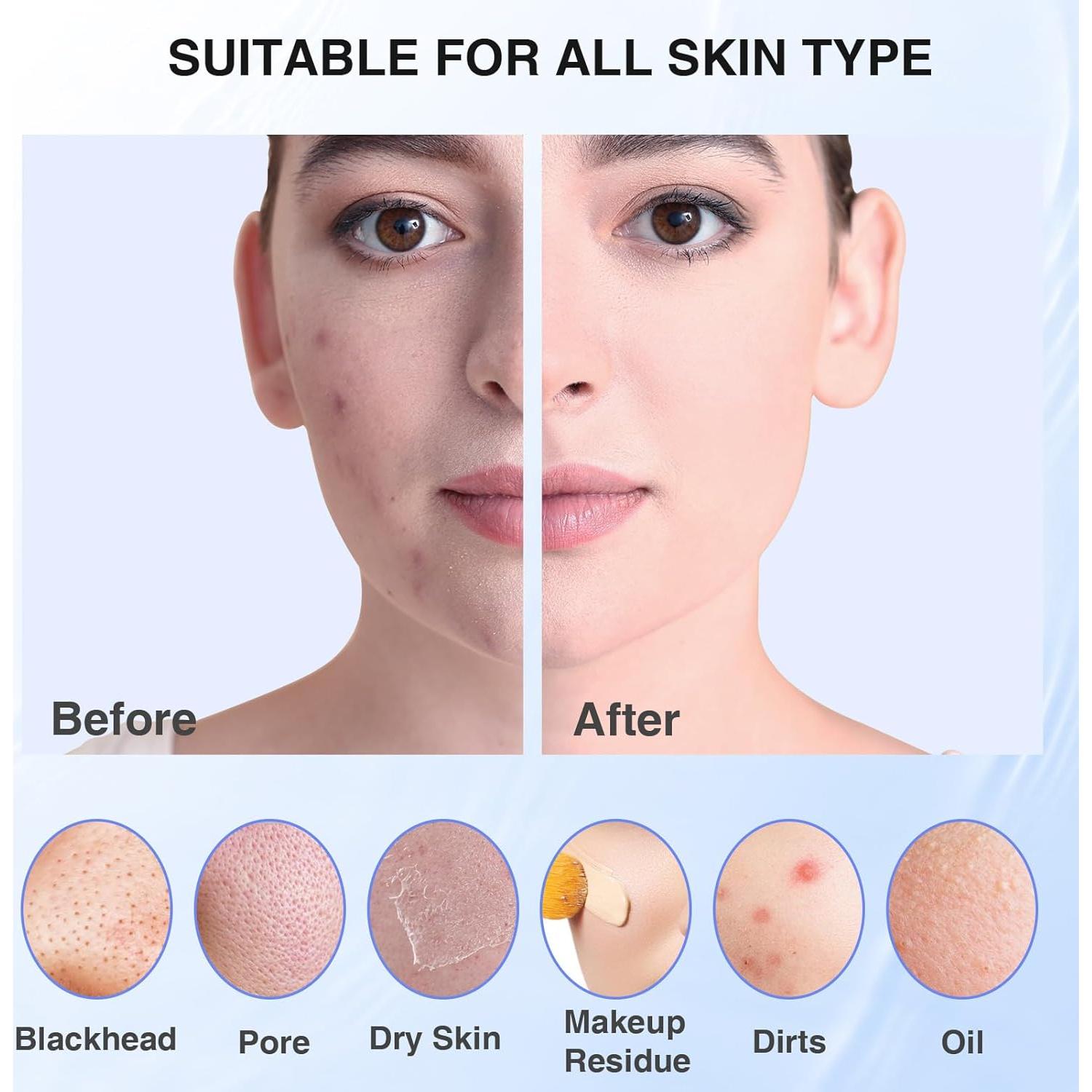 Exfoliador Facial Eléctrico ERROWIN Silicona 5 Modos IPX7