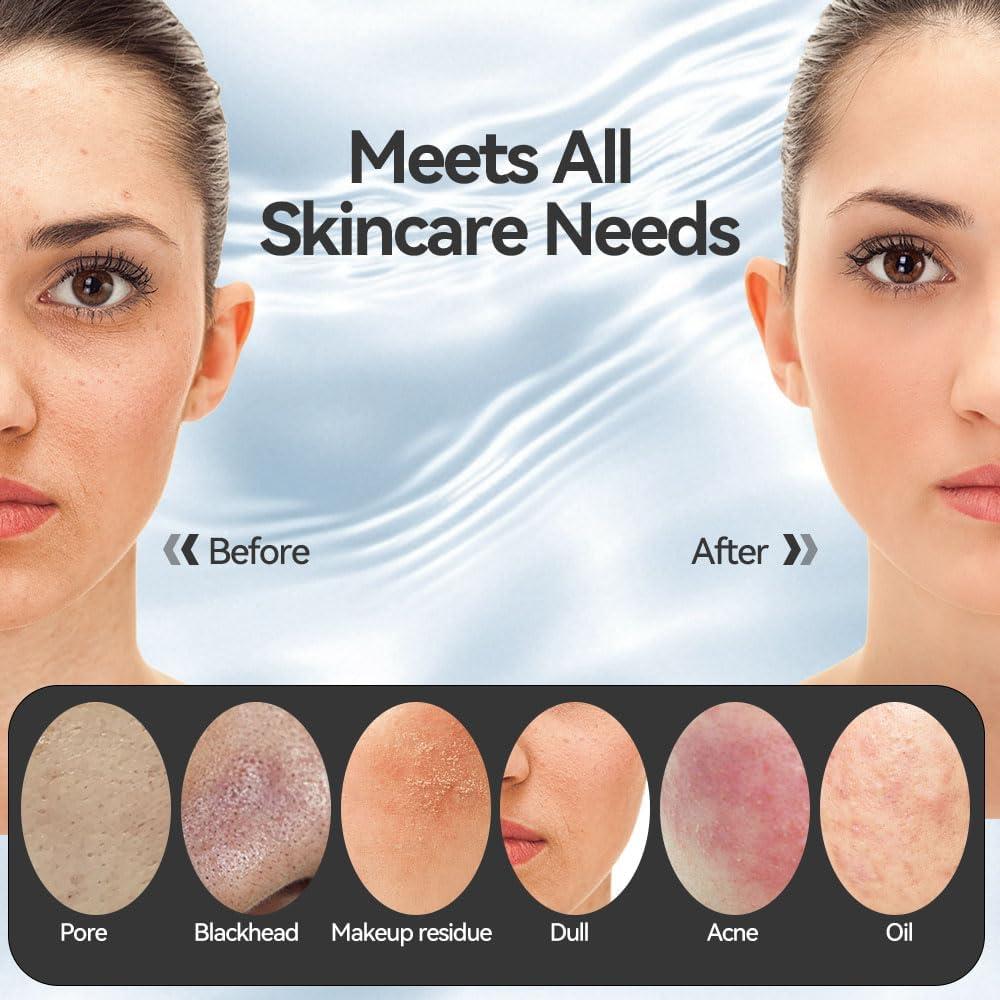 Cepillo Facial Eléctrico Ihelol 5 Velocidades Silicona IPX7