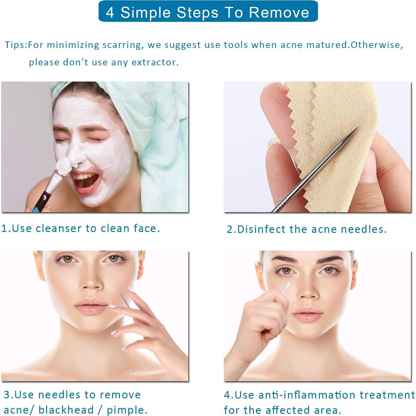 Kit Extractor de Comedones 5 Piezas Kotomotoy Acero Inoxidable