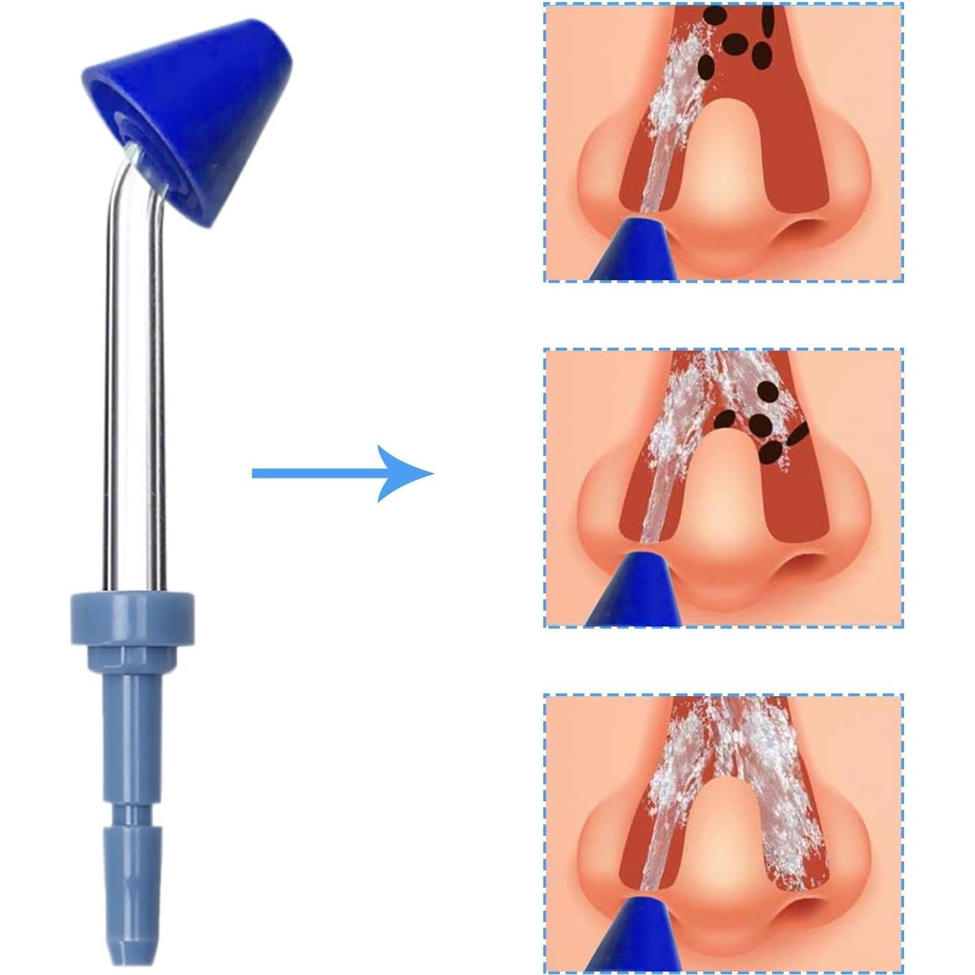 Puntas de Reemplazo para Irrigador Oral Waterpik - 6 Unidades