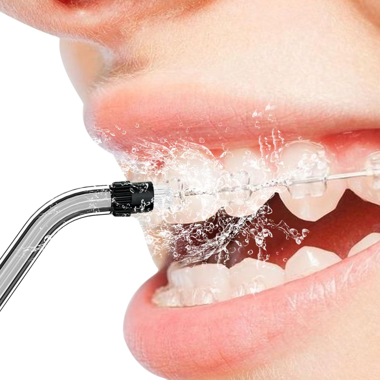 Consejos de Reemplazo Ortodónticos COSLUS F5020E - 4 Piezas